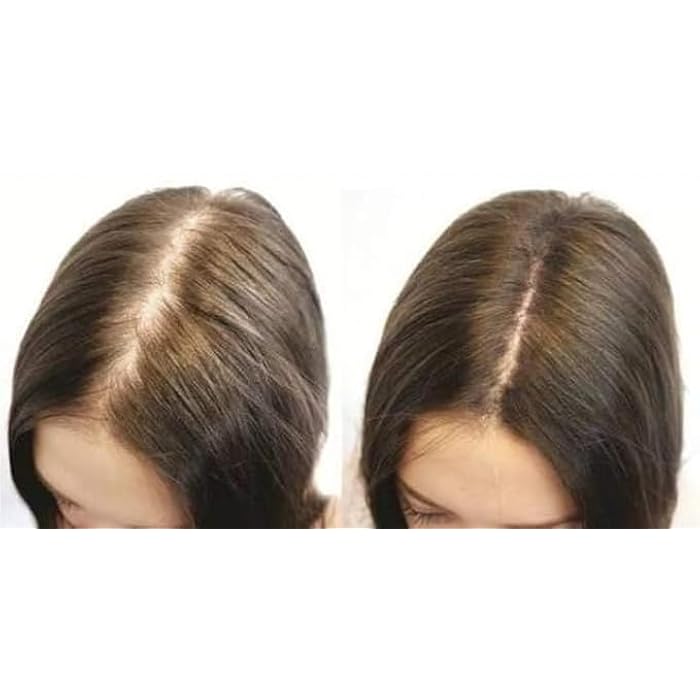 FASTER HAIR BACK CAFFEINE EXTRACT 100ML - Image 2